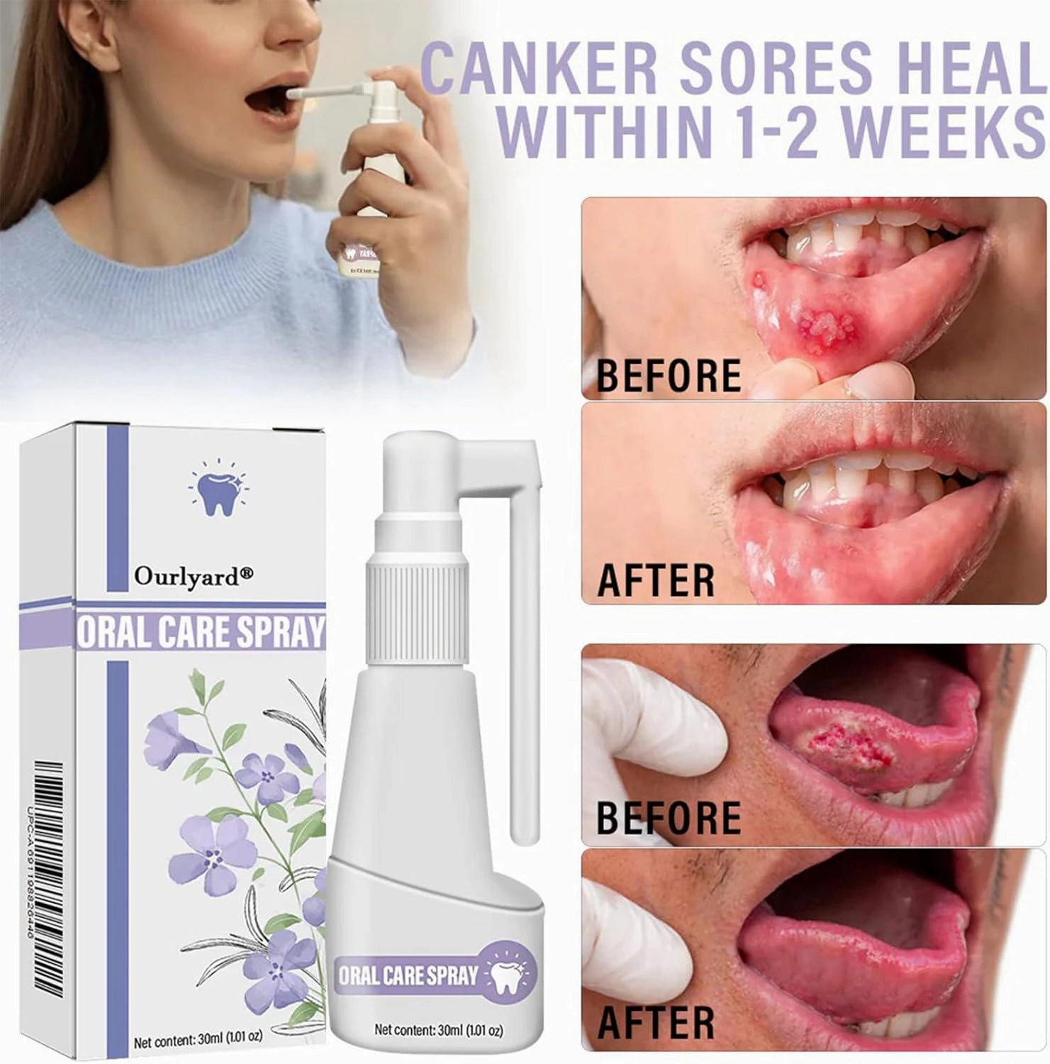 Clove Oil Oral Care Spray,Clove mouthwash,Clove Oil for Teeth and Gums (4PCS)