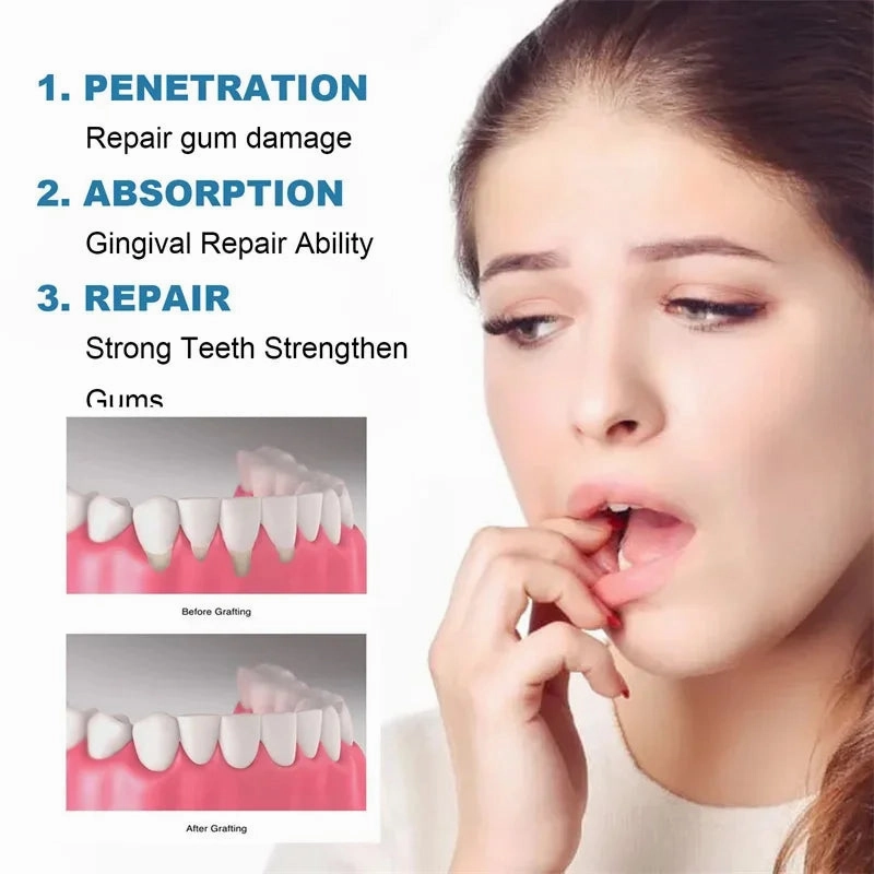 Fast Repair Gums Serum Effectively Relieve Tooth Allergy Dental Caries Tooth Cleaning Toothpaste Relieve Tooth Damage Drops Care
