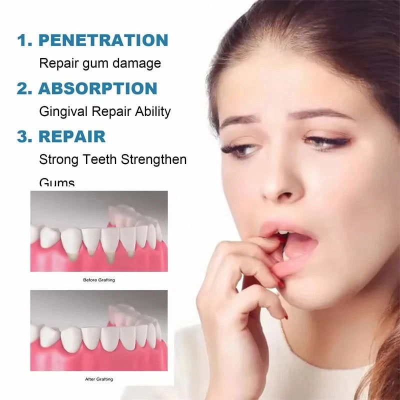 Fast Repair Gums Serum Effectively Relieve Tooth Allergy Dental Caries Tooth Cleaning Toothpaste Relieve Tooth Damage Drops Care