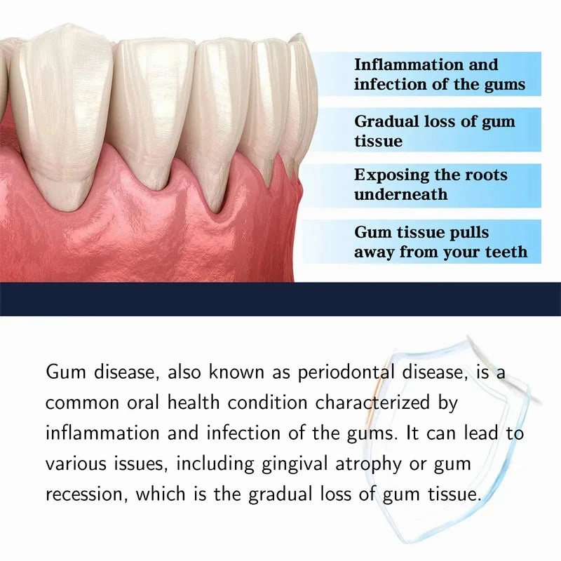 Fast Repair Gums Serum Effectively Relieve Tooth Allergy Dental Caries Tooth Cleaning Toothpaste Relieve Tooth Damage Drops Care