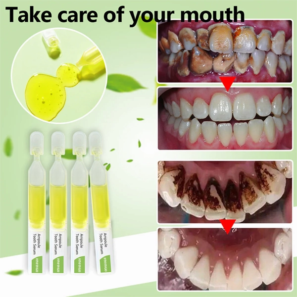 Fivfivgo™ Ampoule Tooth Serum