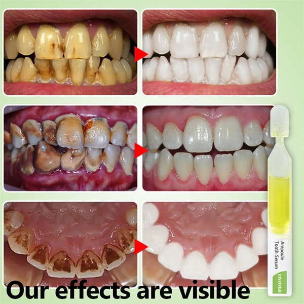 Fivfivgo™ Ampoule Tooth Serum